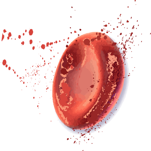 AIHA Hemolysis