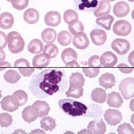 Comparison-of-fresh-and-overnight-blood-sample-150x150