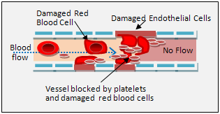 Microangiopathic hemolysis capillary crop