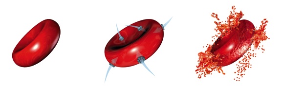 hemolysis
