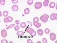 Schistocyte Second Chance Aiha Dogs