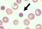 spherocyte