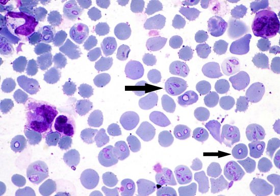 Canine Babesiosis